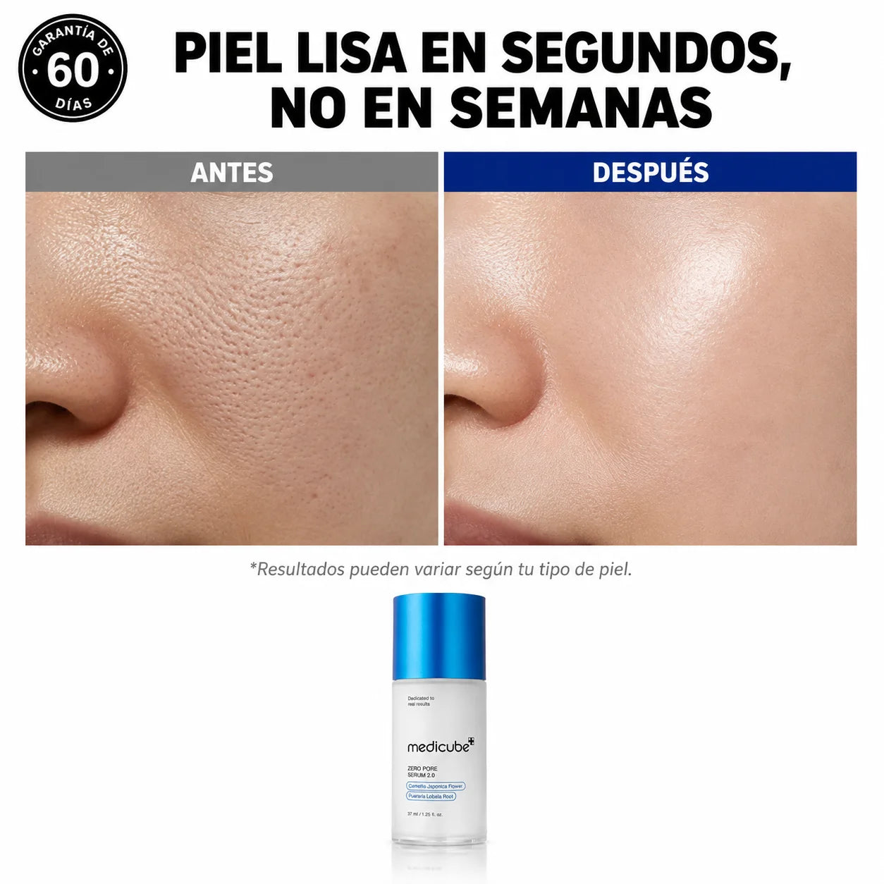 Medicube Zero Pore Serum 2.0 | Para Piel Grasa, Mixta y con Acné — Resultado Inmediato