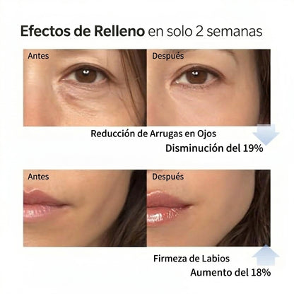 Kit Antiedad de Colágeno — Sérum + Crema Hidratante (2 piezas)